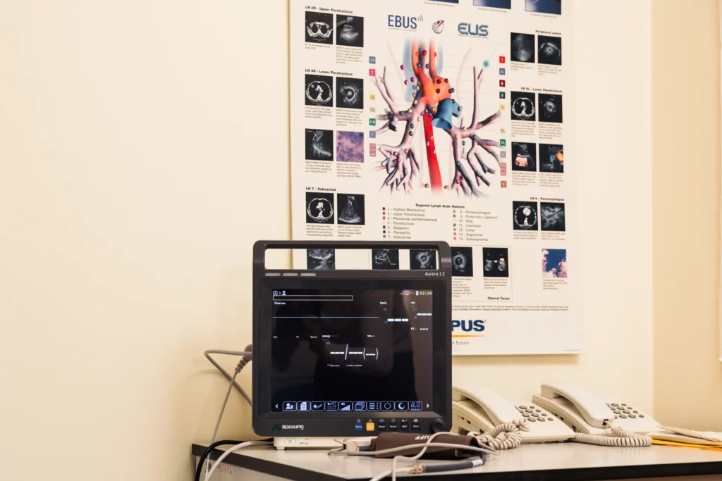 Pulmocenter | Відділення ендоскопії